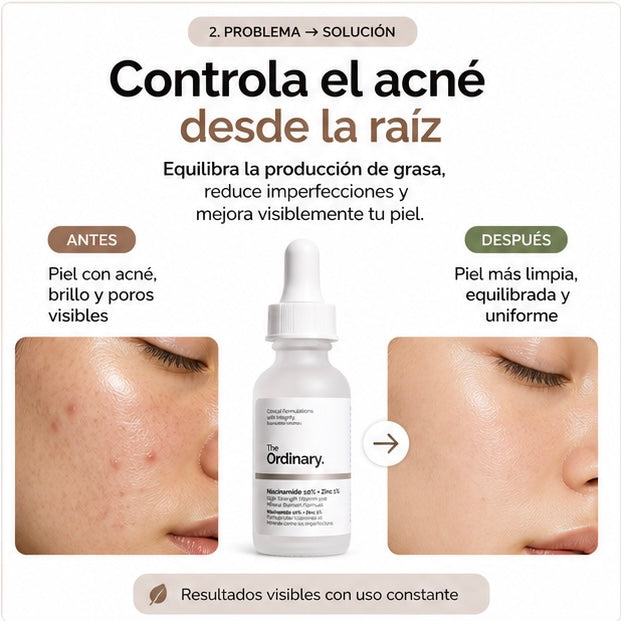 NIACINAMIDA 10% + ZINC 1% 30ML